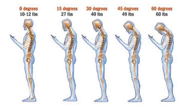 6 Problems Caused By Poor Posture